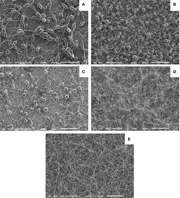 Radicals and Ions Formed in Plasma-Treated Organic Solvents: A Mechanistic Investigation to Rationalize the Enhancement of Electrospinnability of Polycaprolactone